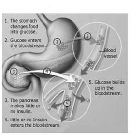 Objectives Review the pathophysiology of diabetes Discuss the prevalence of diabetes in pregnancy Review Diabetes Screening and