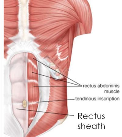 Rectus sheath Rectus abdominis on each side is enclosed by a fibrous sheath. The rectus sheath is formed from decussating fibres from all three lateral abdominal muscles.