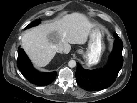 Case 3: 36 year old man with synchronous