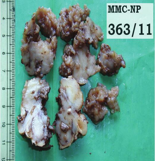 Figure 3: 10x with mitosis. Figure 4: SMA.