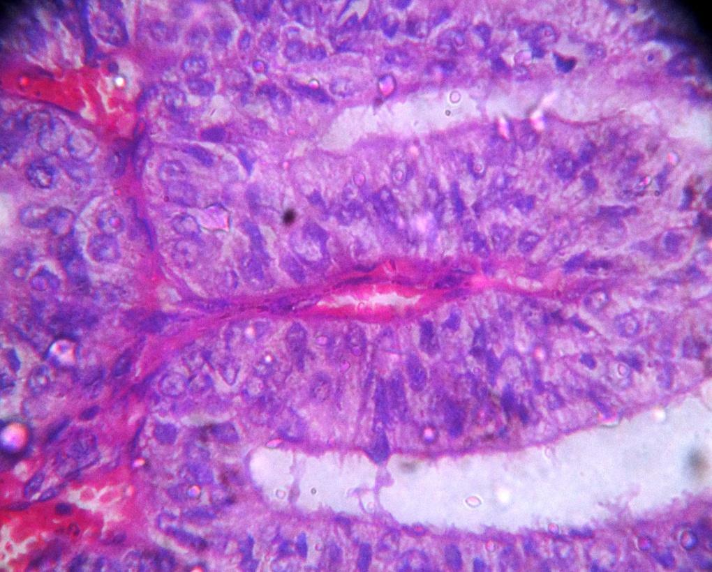 within a cyst like structure made by thin fibrous strands.