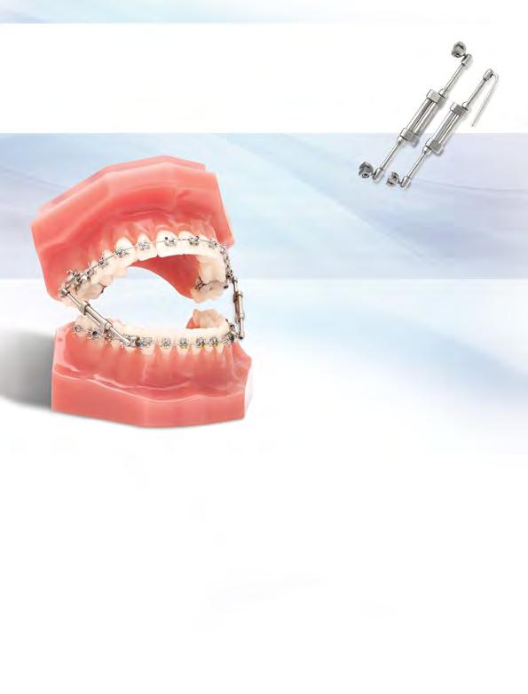 ATTACHMENTS TruEase Bite Corrector Devices Innovative Orthodontic Intraoral Devices for the Correction of Class II and Class III Cases TruEase Double ock Bite Corrector TruEase Anchor Wire Bite