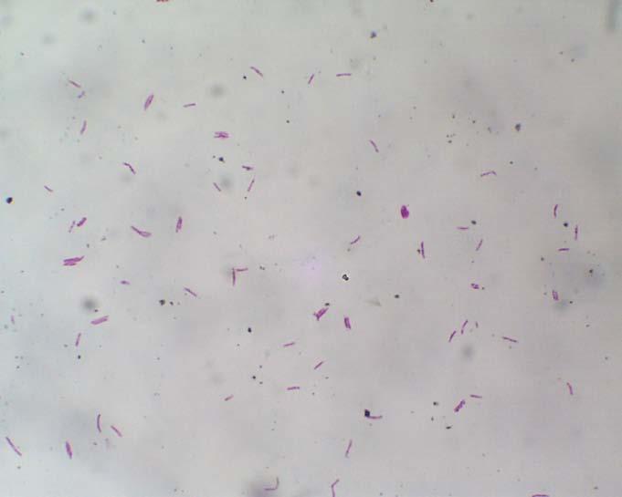 M. tuberculosis concentrated smear 31 Microbiological Diagnosis of Tuberculosis Digestion - mucolytic agents Decontamination