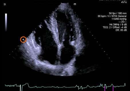 perspectives using Dual V and volume color Doppler with the Z6Ms True