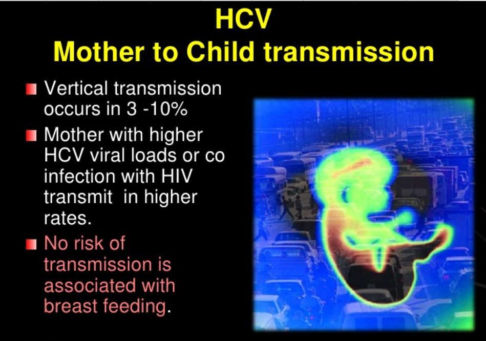 Perinatal transmission Vertical transmission occurs in 3-10%