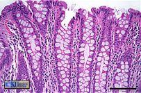 Intestine Simple columnar epithelium Absorption of water and