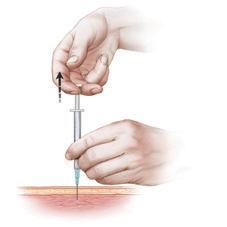 It is important to make sure you are not injecting into a vein, and checking for blood will determine this If no blood enters the syringe, slowly push the plunger in until the syringe is empty If
