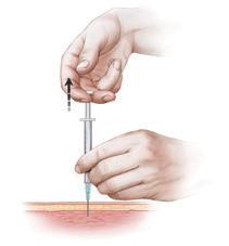 Once the needle is fully in (about 1/8" of the needle should still be visible above the skin), draw back on the plunger to check for blood.