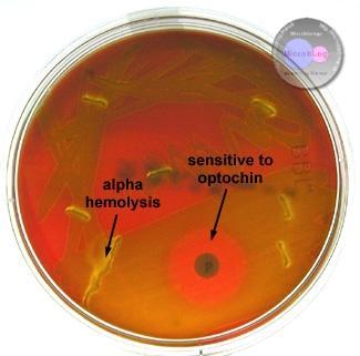 To Differentiate α-haemolytic Streptococci Add an Optochin disc to the blood agar plate within the area of 2 nd spread before