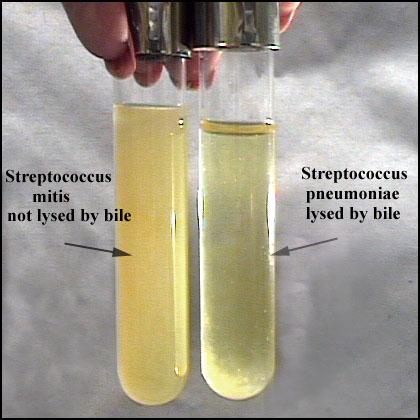 Bile Solubility Test When a bile salt (such as Na- deoxycholate) is added directly to S.