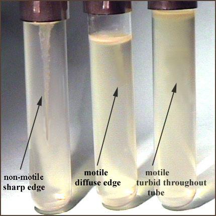 Motility Test Test Procedure Inoculate tubes by stabbing through