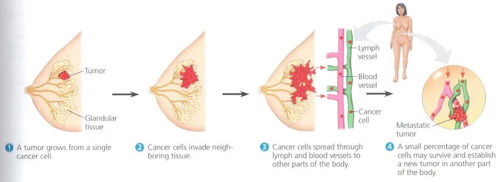 METASTASIS a few tumour cells separate from original tumour enter