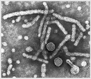 Hepatitis B Virus Family: Hepadnaviridae