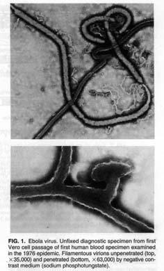 Ebola Virus Family: Filoviridae (-) SS