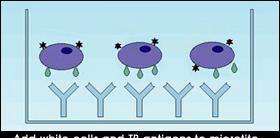 T-SPOT TB (ELISPOT) Obtain blood, isolate cells, place