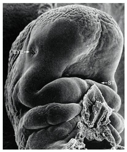 Head and Neck of an Embryo at 4 Weeks 12