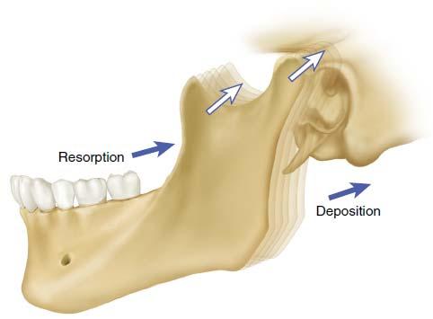 Mandible Grows by Displacement, Resorption, and Deposition Elsevier