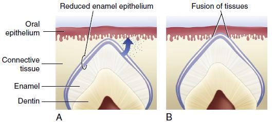 Stages in the Process of Tooth Eruption Elsevier