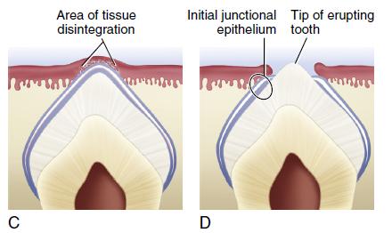 Stages in the Process of Tooth Eruption (Cont.