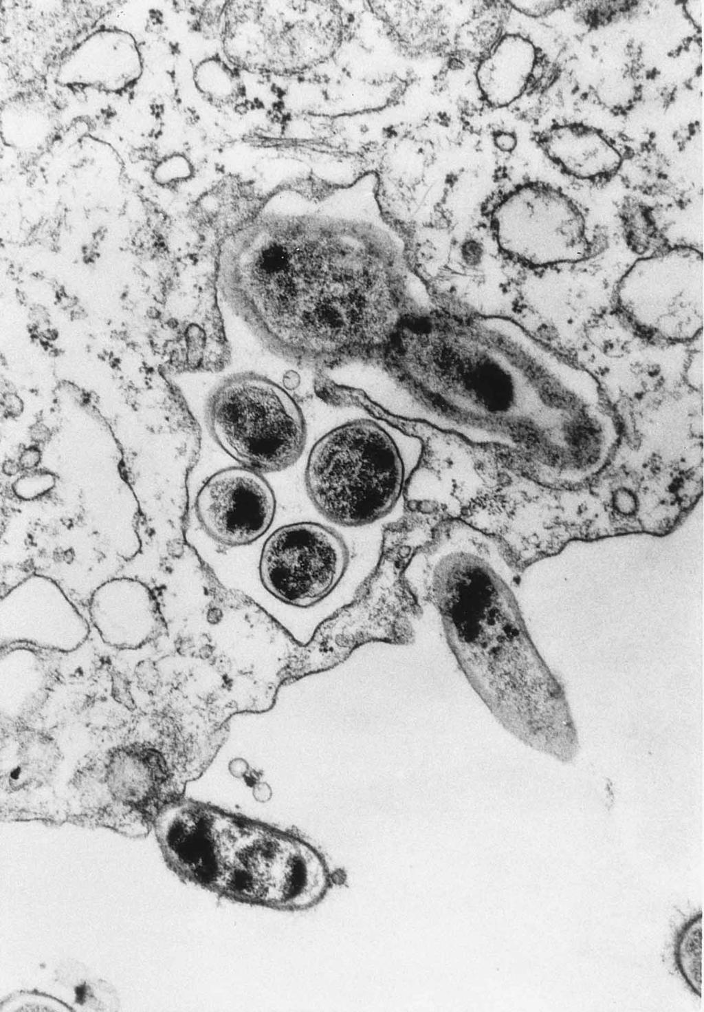 VOL. 10, 1997 BARTONELLA SPP. AS EMERGING HUMAN PATHOGENS 205 Downloaded from http://cmr.asm.org/ FIG. 1. Electron micrograph of low-passage-number (piliated) B. henselae associated with HEp-2 cells.