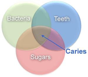 Etiology: The Triad 17 What causes dental caries? Caries is a multi-step process that results in destruction of the tooth structure.