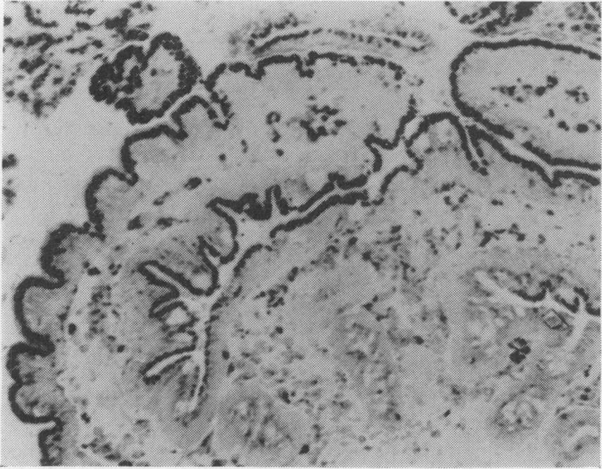 Acid phosphatase. The activity is confined to lysosomal bodies beneath the brush border of the absorptive epithelium and to macrophages. of the lamina propria. x 130. FG. 1 b.