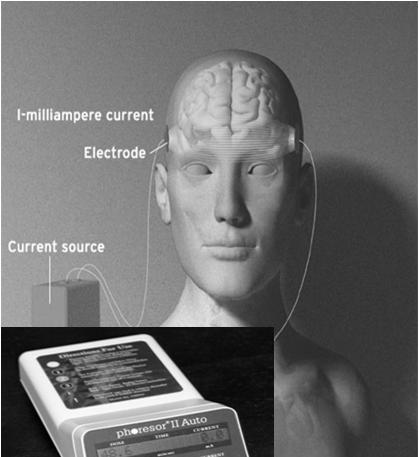 Transcranial Direct Current Stimulation in HIV-Infected, Depressed Persons Safety,Tolerability and Feasibility of tdcs for HIV+ Persons Racial and Ethnic Minorities with MDD tdcs was an Safe,