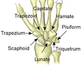 Osteology of the Wrist (Bones) Ten bones are involved: the distal radius, distal ulna, and eight carpal bones (wrist bones) The carpal bones are arranged in 2 rows of 4 bones each Starting on the