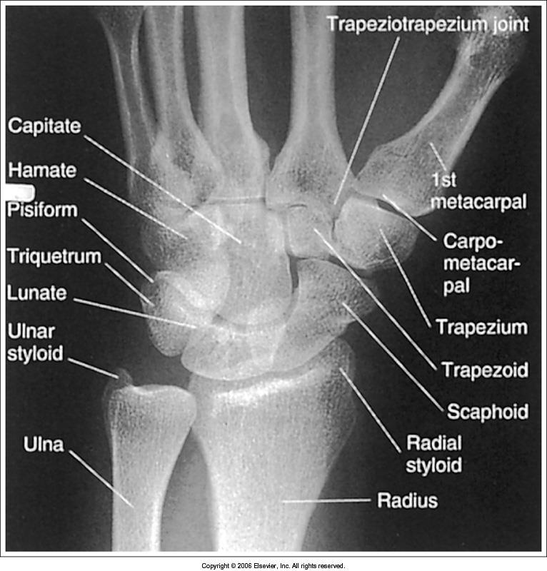 PA Oblique Wrist Criteria for Evaluation The trapezium and should be demonstrated The of the scaphoid should be demonstrated.