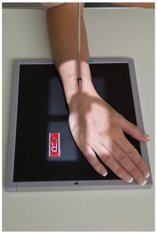 WRIST PA Projection in Radial Flexion/Radial Deviation Patient