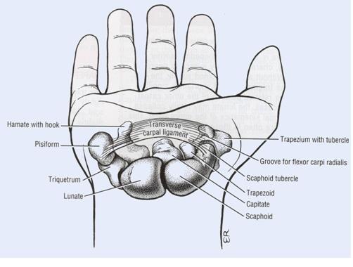 What is Carpal Tunnel?