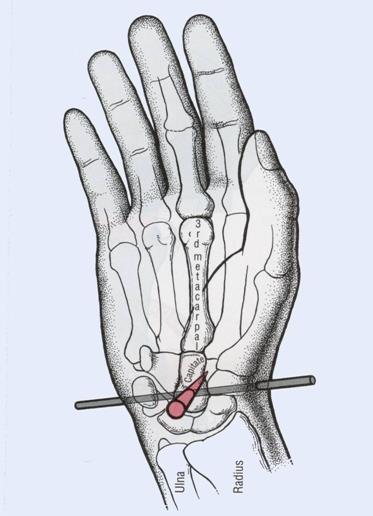 The axis runs in a medial-lateral direction for flexion and
