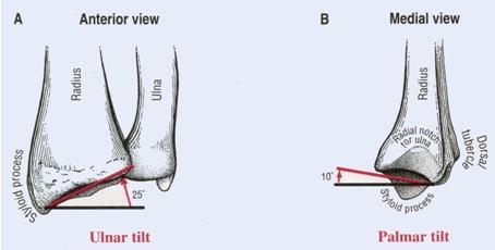 Distal end of the radius A.