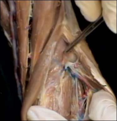 Locate and clean the deep radial nerve in the forearm and separate it from the posterior