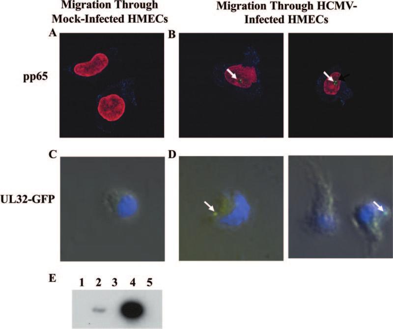 VOL. 80, 2006 HCMV ENDOTHELIAL CELL INFECTION AND DISSEMINATION 11551 FIG. 10. HCMV can be transferred from the infected endothelial cell to a monocyte undergoing transendothelial migration.