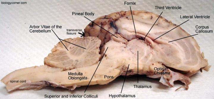 Section B. Internal Sheep Brain. 1. Use a knife or long-bladed scalpel to cut the specimen along the longitudinal fissure.