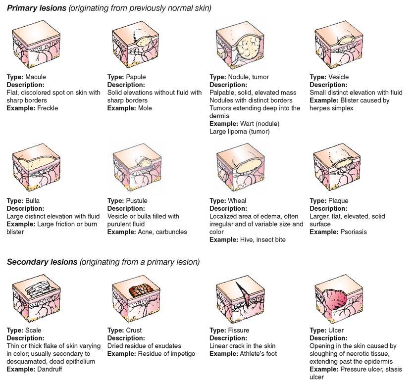 Classification of skin lesions