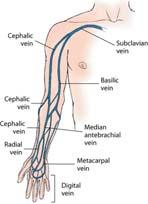 Peripheral Venous Cannulation Noncritical patients Distal veins on dorsum of hands and arms Peripheral