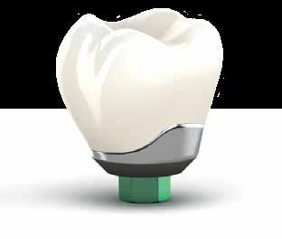 Our implants are lightweight, durable, biocompatible and made from titanium, the most widely used material in implant