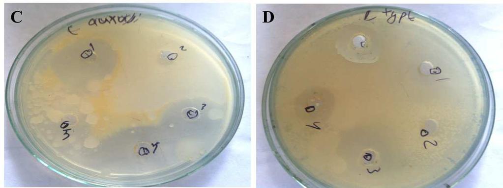 subtilis Ethanol 19 18 27 20 Methanol 37 24 19 22 Butanol 15 08 20 10 Acetone 17 26 27 26 Hexane 17 20 25 21 The tested bacteria responded in a different way to garlic extracts.