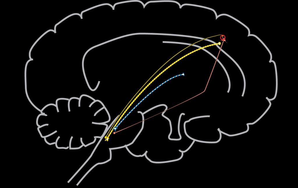 Cortical 5HT2A striatum raphe nucleus accumbens brainstem neurotransmitter centers substantia