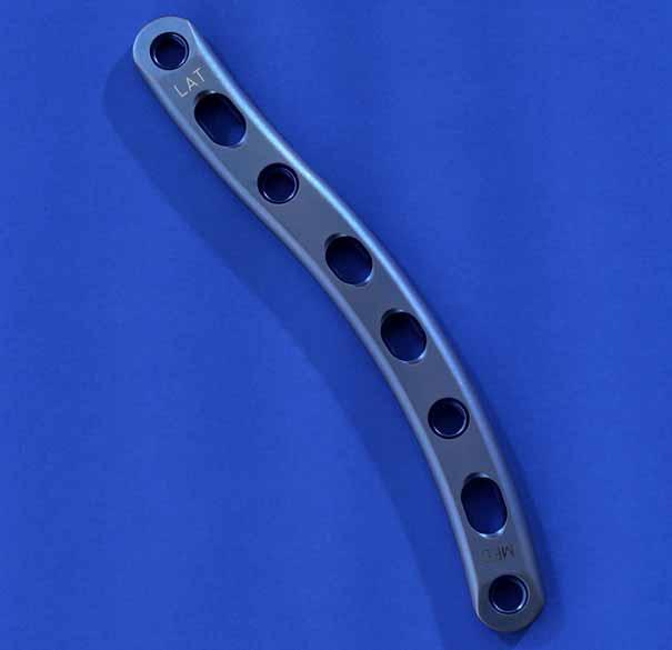 For central one-third applications, there are five different lengths and curvatures in both left (blue) and right (green), and for distal/lateral fractures two specialized J plates are available.