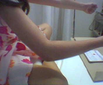 A 7 year old girl presents having fallen on an outstretched hand. She is unable to fully extend her elbow and is in pain Can the SWEET rule be applied to children? Does she need an x-ray?