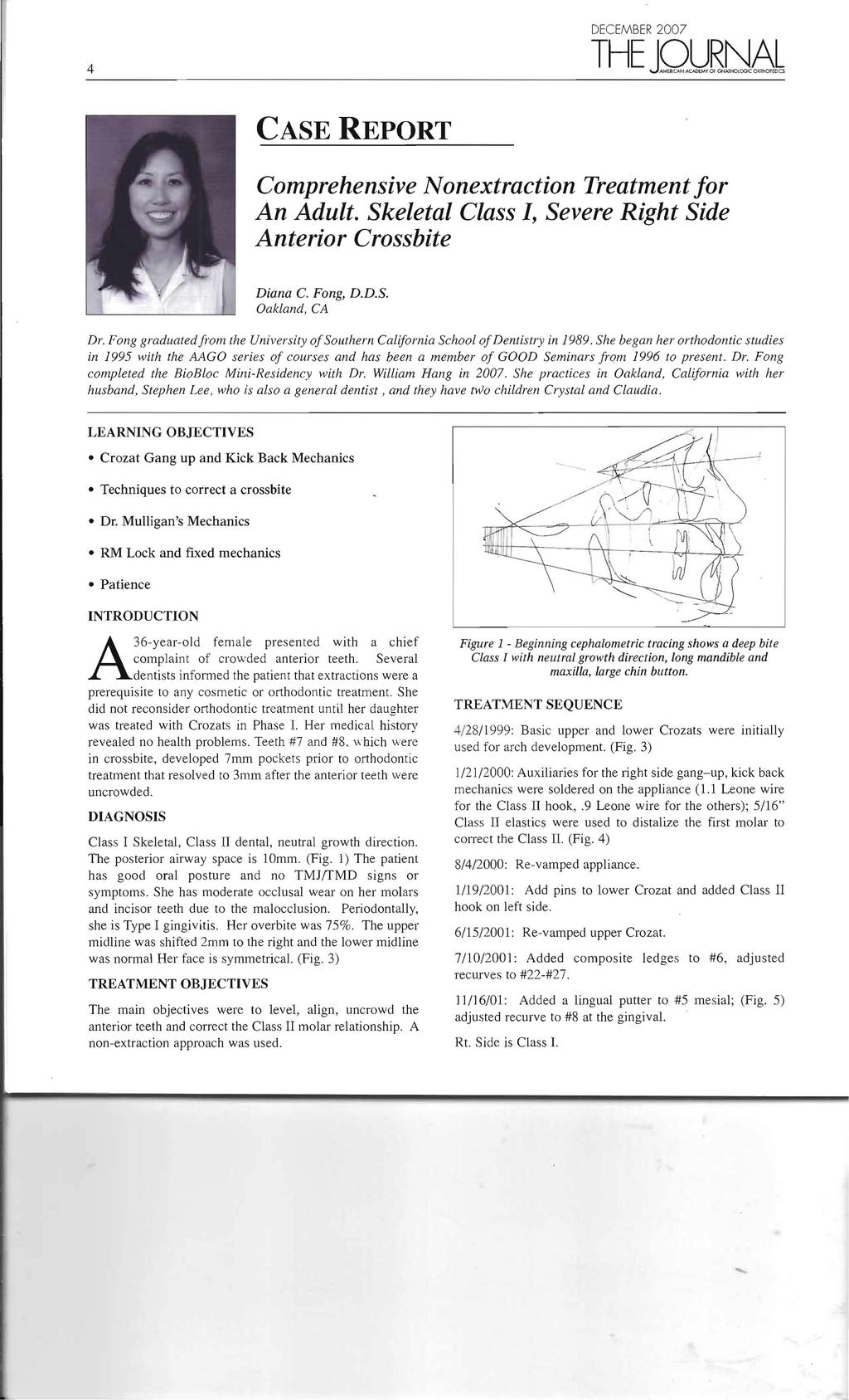 4 DECEMBER 2007 THE JQUR1l6L CASE REPORT Comprehensive Nonextraction Treatment for An Adult. Skeletal Class I, Severe Right Side Anterior Crossbite Diana C. Fang, D.D.S. Oakland. CA Dr.