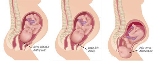 LABOUR & DELIVERY Uterine contractions cause an extra 300 to 500 mls of blood to enter