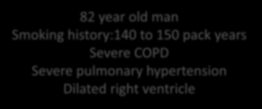 Severe COPD Severe pulmonary