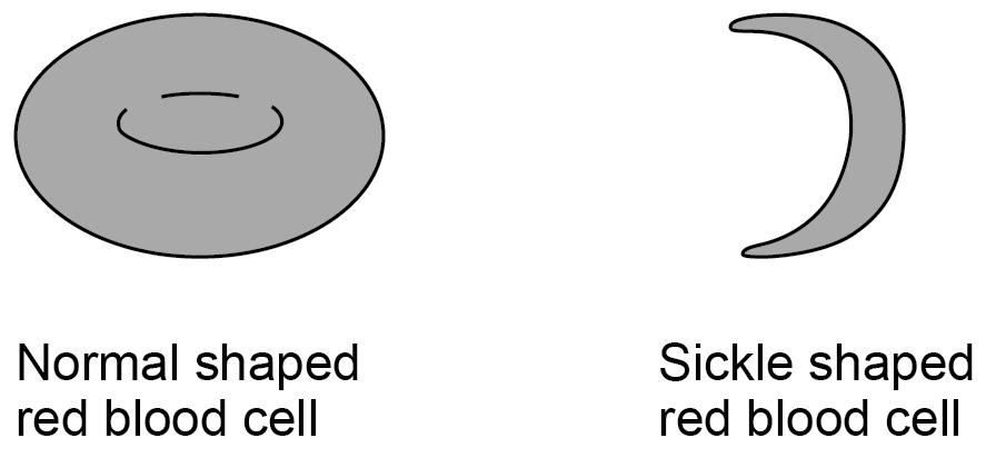 30 Sickle cell disease is an inherited disorder that causes some red blood cells to have a sickle shape. Figure 7 shows two red blood cells.