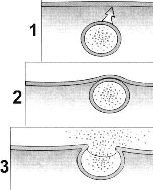 18. The process illustrated bove is called: a. facilitated diffusion. c. cotransport. b. pinocytosis d. exocytosis 19. What cell process is responsible for the effect shown in Figure 8-5?