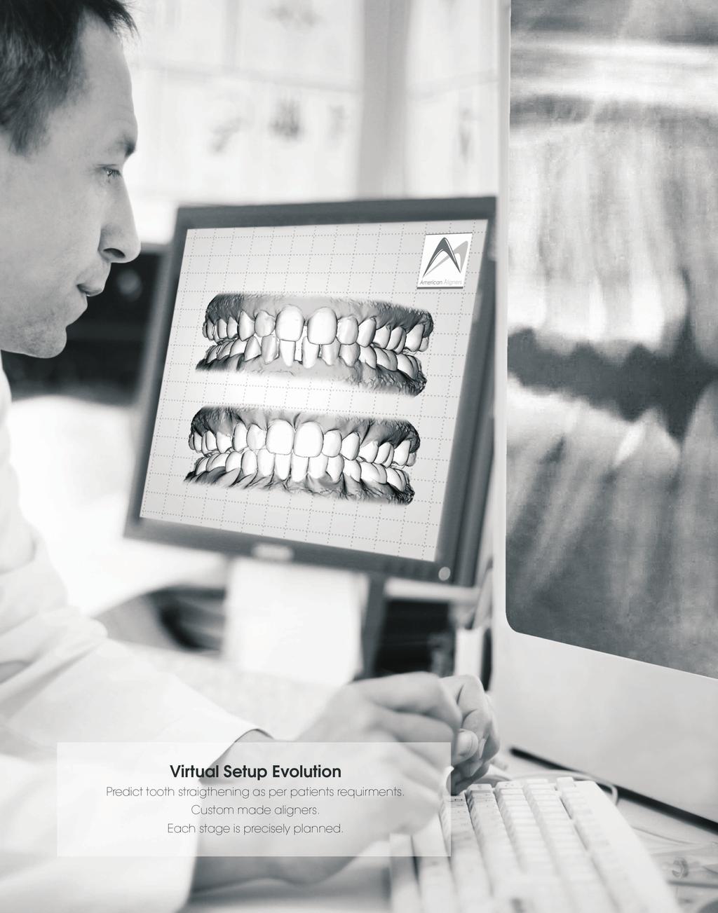 Virtual Setup Evolution Predict tooth straightening as per patients
