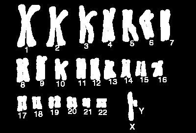 Human Karyotype A complete set of chromosomes of an organism placed into pairs of matching chromosomes is called a